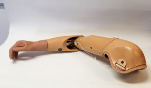 Hybrid armprotese
