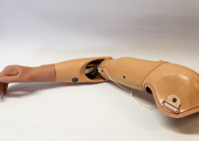 Hybrid armprotese